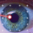 001-2022-01-18-eye.jpg - Ozersk74.Ru